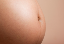 Recovery and Care After a C-Section: A Practical Guide for First-Time Moms